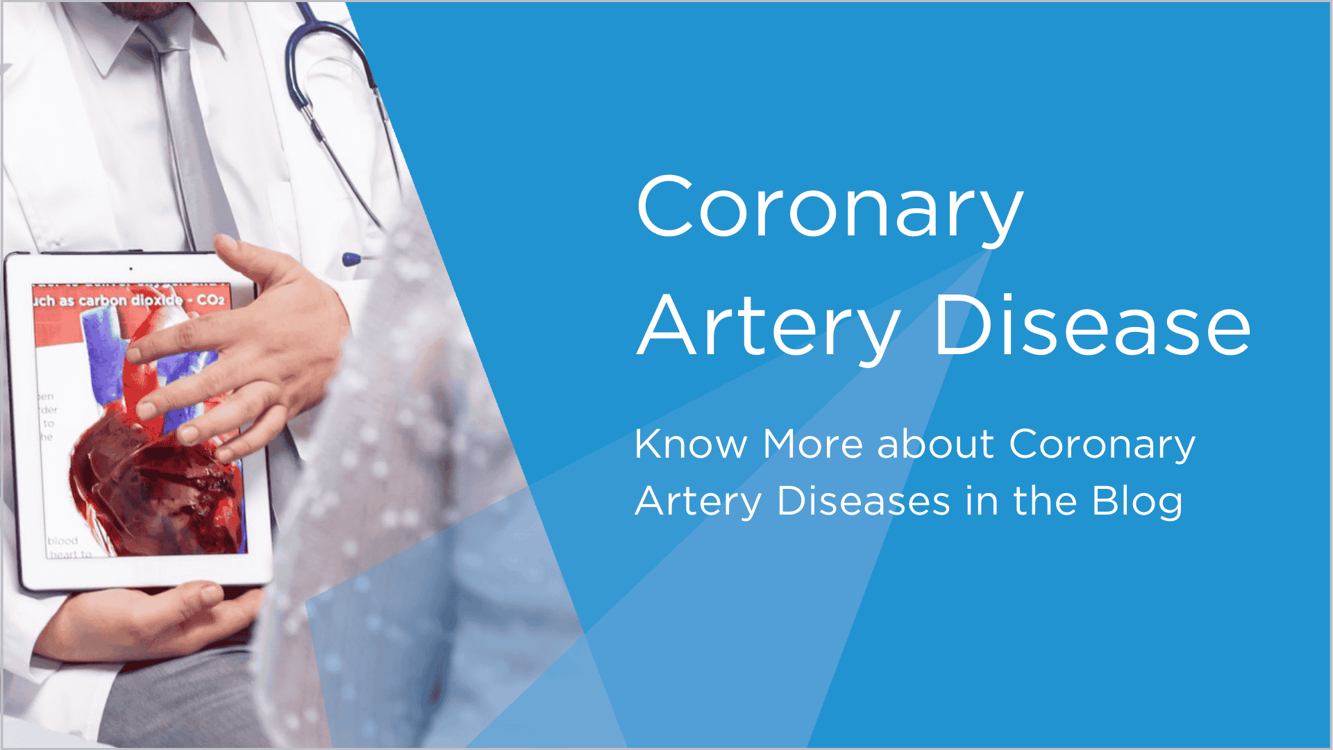 Coronary Artery Disease