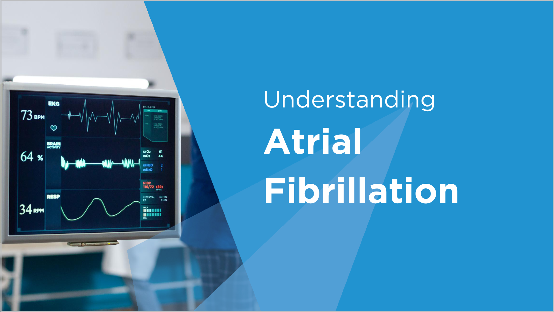 Understanding of Atrial Fibrillation